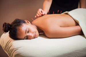 acupunctura a domiclio en barcelona