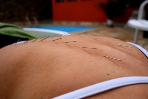 acupuntura cursos barcelona